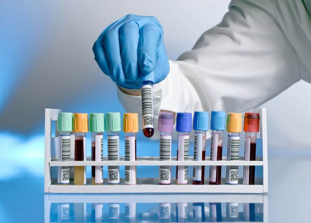ujian darah untuk pelepasan patologi semasa rangsangan