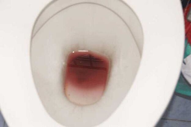 tompok pada lelaki apabila teruja